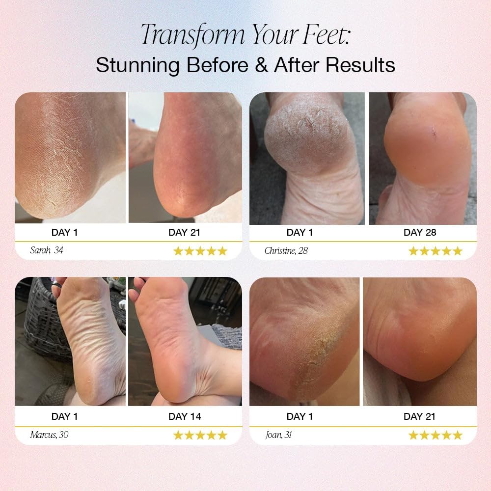 Vitalis Beauty™ Rechargeable Electric Foot Callus Remover – 2-in-1
