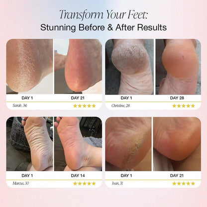Vitalis Beauty™ Rechargeable Electric Foot Callus Remover – 2-in-1